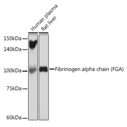 Western Blot - Anti-Fibrinogen Alpha Chain Antibody [ARC2227] (A308025) - Antibodies.com