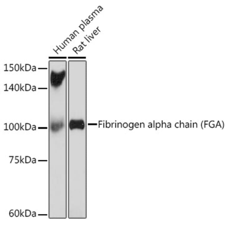 Western Blot - Anti-Fibrinogen Alpha Chain Antibody [ARC2227] (A308025) - Antibodies.com