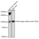 Western Blot - Anti-Fibrinogen Alpha Chain Antibody [ARC2227] (A308025) - Antibodies.com