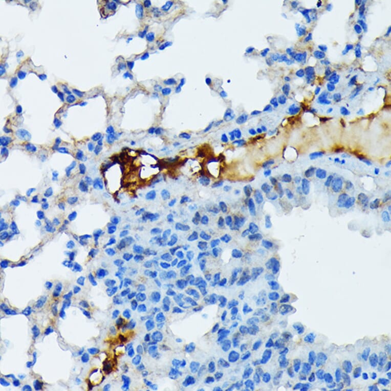 Immunohistochemistry - Anti-Fibrinogen Alpha Chain Antibody [ARC2227] (A308025) - Antibodies.com