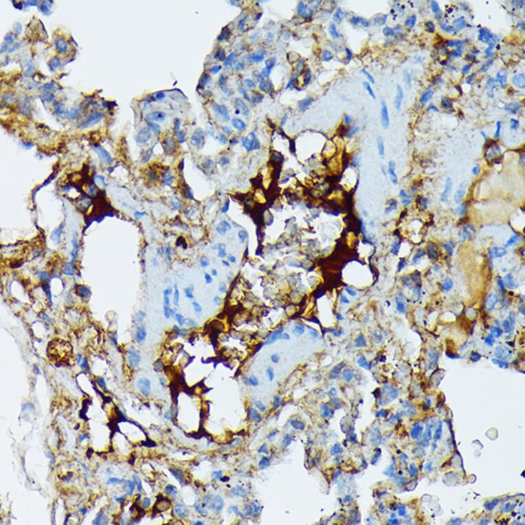 Immunohistochemistry - Anti-Fibrinogen Alpha Chain Antibody [ARC2227] (A308025) - Antibodies.com