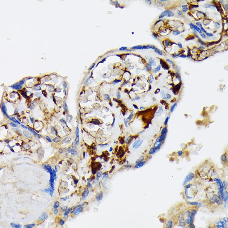 Immunohistochemistry - Anti-Fibrinogen Alpha Chain Antibody [ARC2227] (A308025) - Antibodies.com