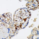 Immunohistochemistry - Anti-Fibrinogen Alpha Chain Antibody [ARC2227] (A308025) - Antibodies.com