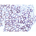 Immunohistochemistry - Anti-Bag3 Antibody [ARC1104] (A308026) - Antibodies.com