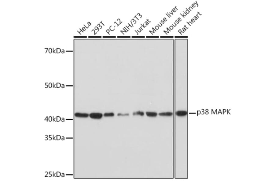 Western Blot - Anti-p38 alpha/MAPK14 Antibody [ARC0201] (A308027) - Antibodies.com