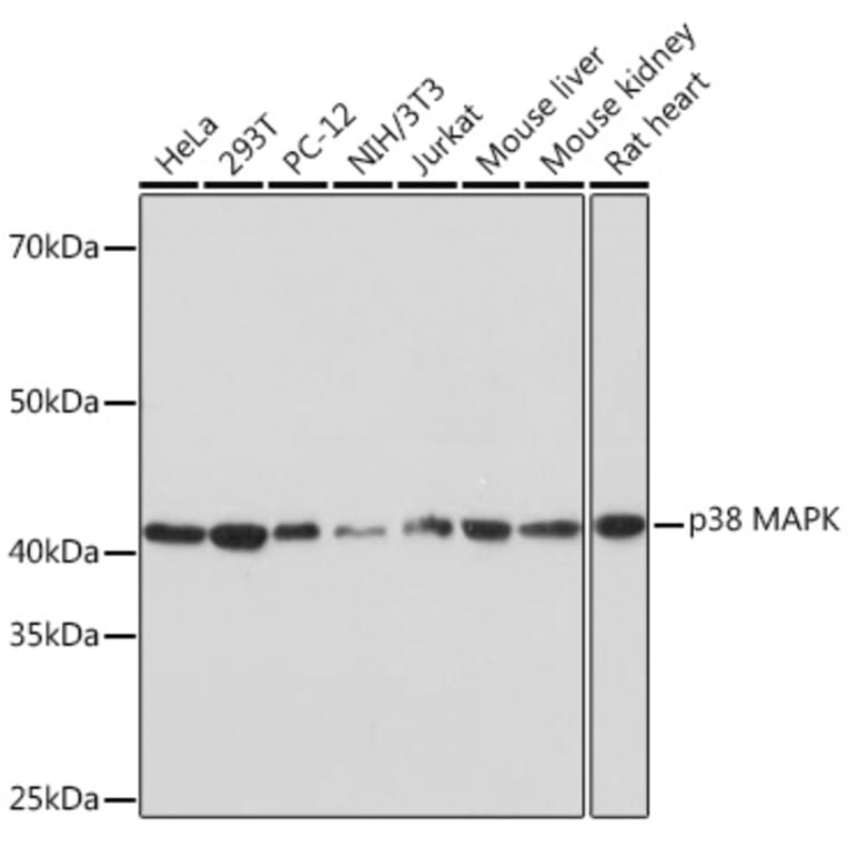 Western Blot - Anti-p38 alpha/MAPK14 Antibody [ARC0201] (A308027) - Antibodies.com