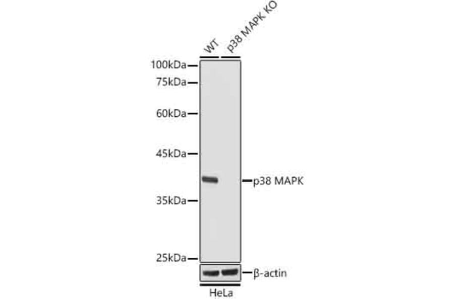 Western Blot - Anti-p38 alpha/MAPK14 Antibody [ARC0201] (A308027) - Antibodies.com