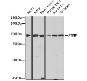 Western Blot - Anti-ATRIP Antibody [ARC2460] (A308031) - Antibodies.com