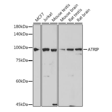 Western Blot - Anti-ATRIP Antibody [ARC2460] (A308031) - Antibodies.com