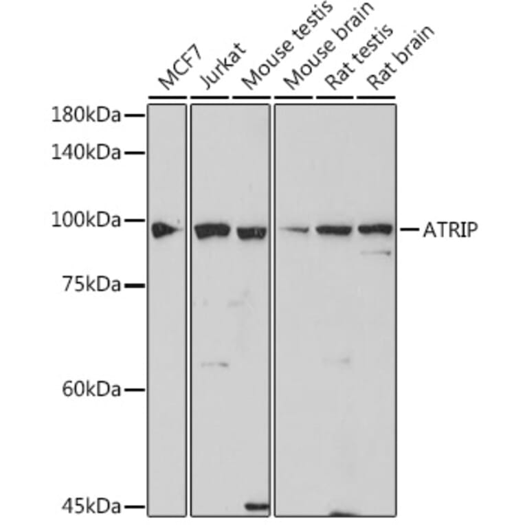 Western Blot - Anti-ATRIP Antibody [ARC2460] (A308031) - Antibodies.com