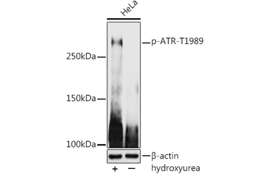 Western Blot - Anti-ATR (phospho Thr1989) Antibody (A308032) - Antibodies.com