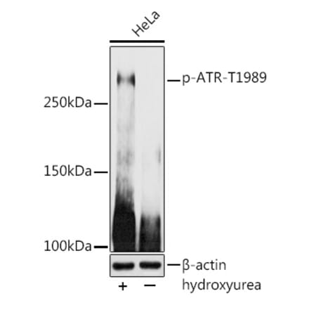 Western Blot - Anti-ATR (phospho Thr1989) Antibody (A308032) - Antibodies.com