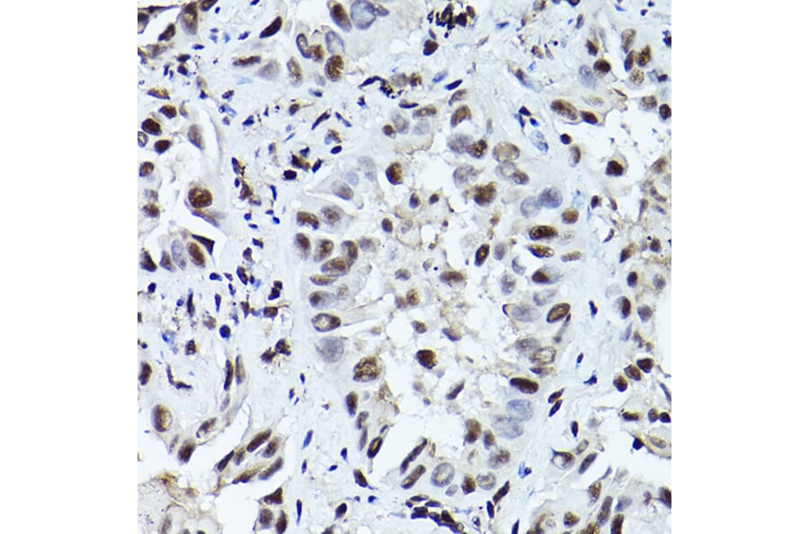 Immunohistochemistry - Anti-ATR (phospho Thr1989) Antibody (A308032) - Antibodies.com
