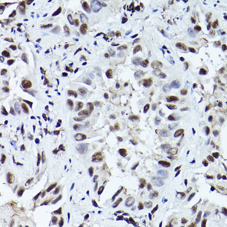 Immunohistochemistry - Anti-ATR (phospho Thr1989) Antibody (A308032) - Antibodies.com
