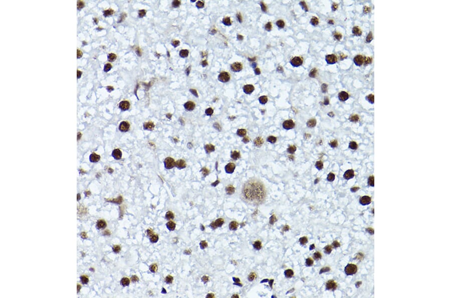 Immunohistochemistry - Anti-ATR (phospho Thr1989) Antibody (A308032) - Antibodies.com