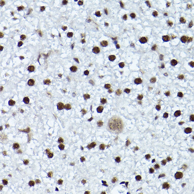Immunohistochemistry - Anti-ATR (phospho Thr1989) Antibody (A308032) - Antibodies.com