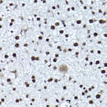 Immunohistochemistry - Anti-ATR (phospho Thr1989) Antibody (A308032) - Antibodies.com