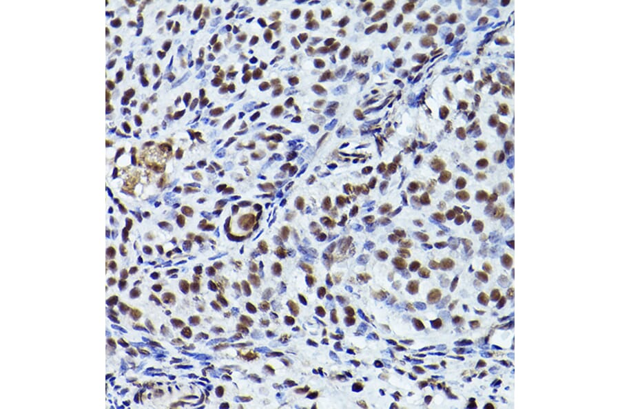 Immunohistochemistry - Anti-ATR (phospho Thr1989) Antibody (A308032) - Antibodies.com