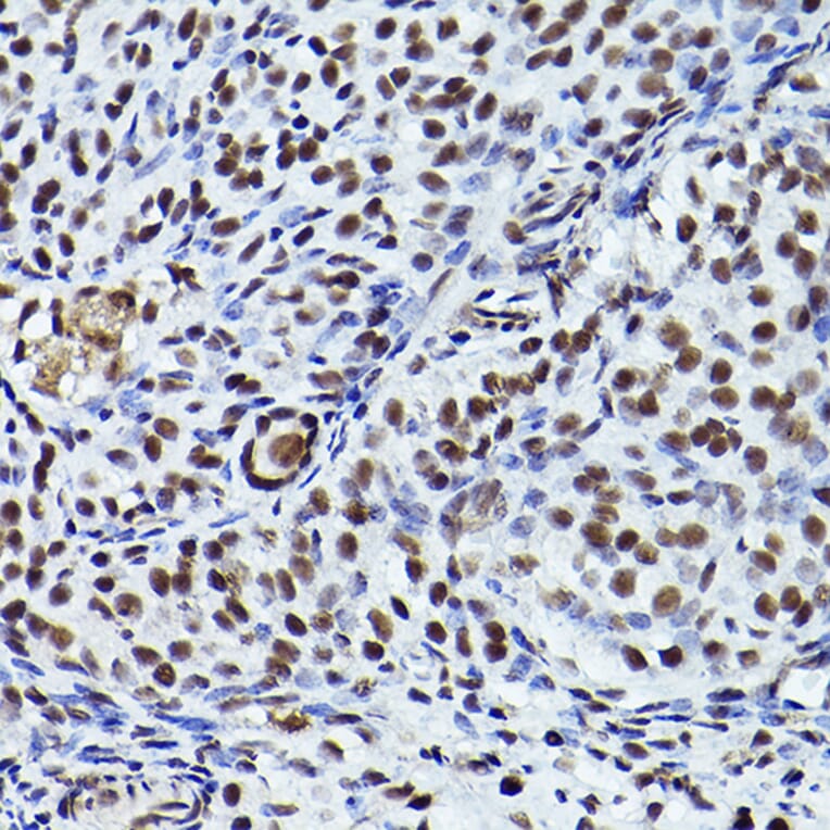 Immunohistochemistry - Anti-ATR (phospho Thr1989) Antibody (A308032) - Antibodies.com