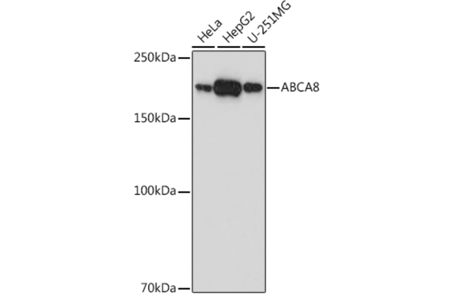Western Blot - Anti-ABCA8 Antibody (A308033) - Antibodies.com