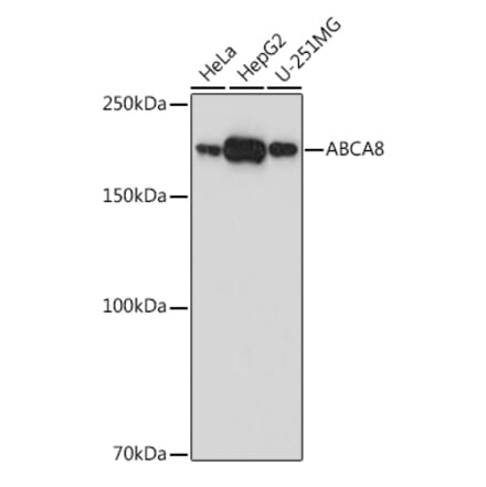 Western Blot - Anti-ABCA8 Antibody (A308033) - Antibodies.com