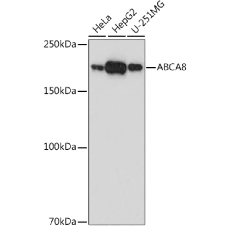 Western Blot - Anti-ABCA8 Antibody (A308033) - Antibodies.com
