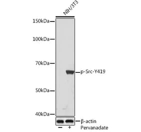 Western Blot - Anti-Src (phospho Tyr419) Antibody [ARC1572] (A308034) - Antibodies.com