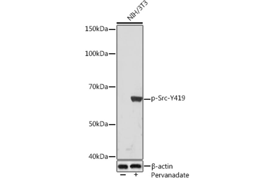 Western Blot - Anti-Src (phospho Tyr419) Antibody [ARC1572] (A308034) - Antibodies.com