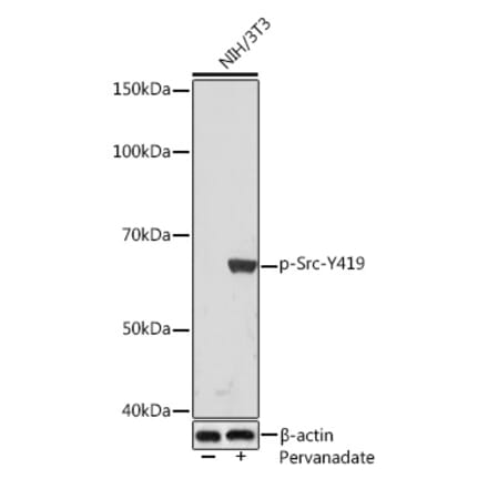Western Blot - Anti-Src (phospho Tyr419) Antibody [ARC1572] (A308034) - Antibodies.com