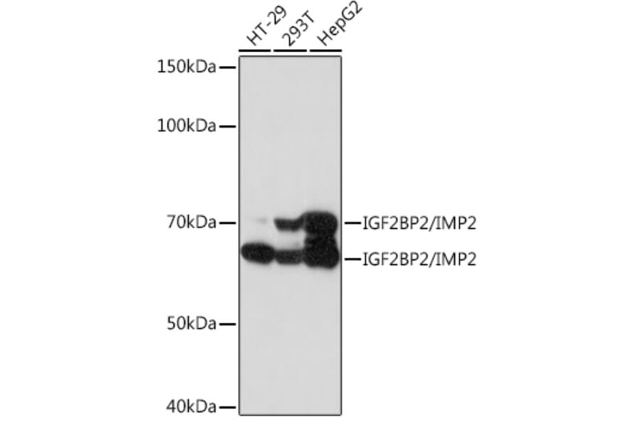 Western Blot - Anti-IGF2BP2/IMP-2 Antibody [ARC1203] (A308035) - Antibodies.com
