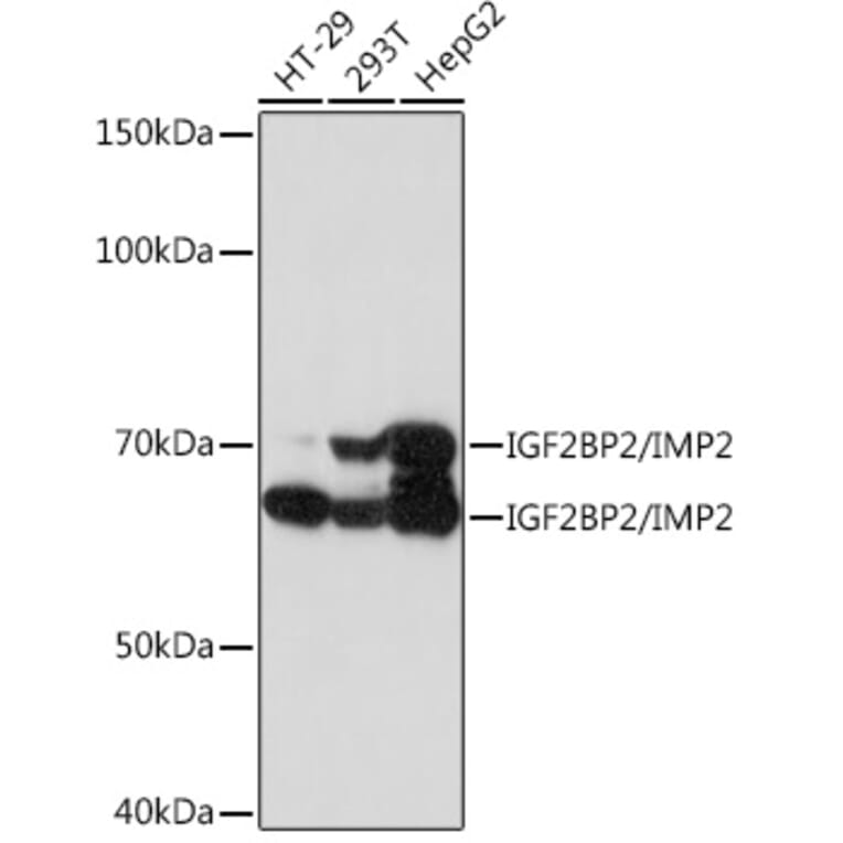 Western Blot - Anti-IGF2BP2/IMP-2 Antibody [ARC1203] (A308035) - Antibodies.com