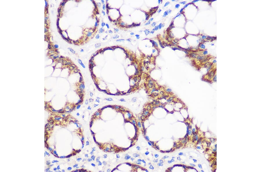 Immunohistochemistry - Anti-IGF2BP2/IMP-2 Antibody [ARC1203] (A308035) - Antibodies.com