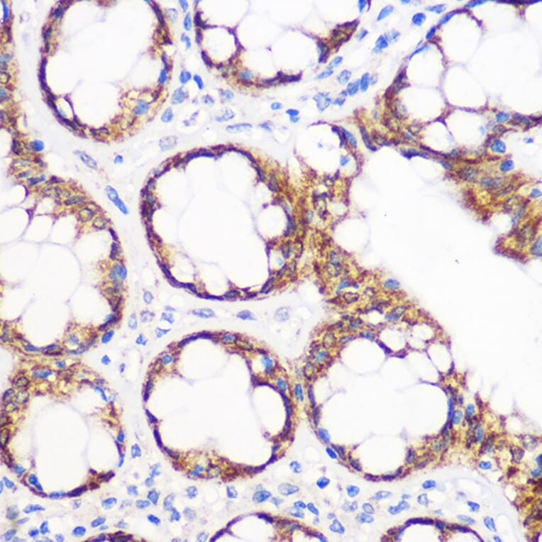 Immunohistochemistry - Anti-IGF2BP2/IMP-2 Antibody [ARC1203] (A308035) - Antibodies.com