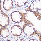 Immunohistochemistry - Anti-IGF2BP2/IMP-2 Antibody [ARC1203] (A308035) - Antibodies.com