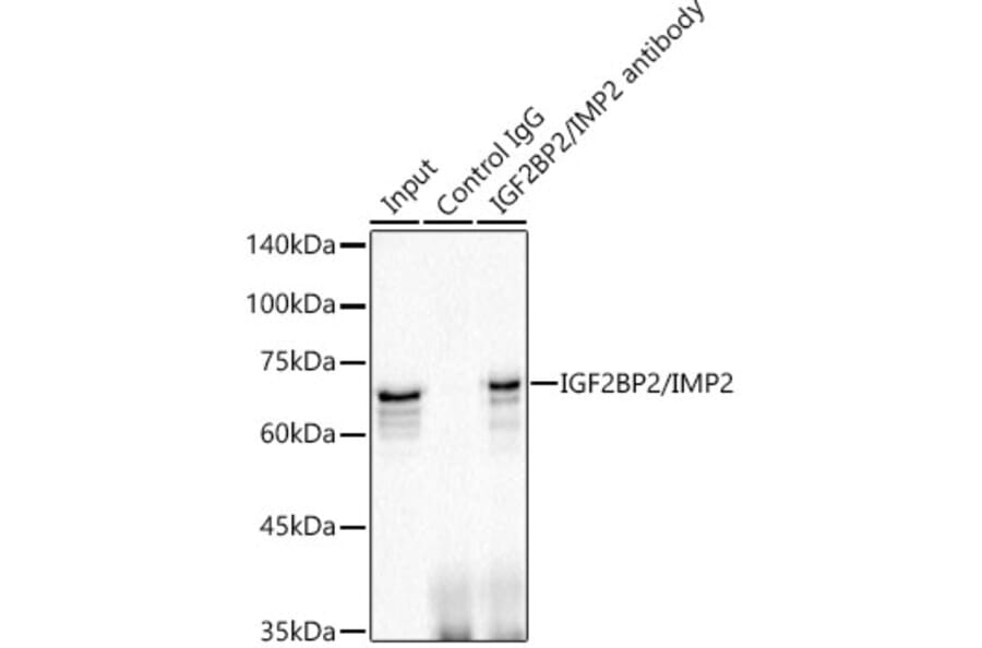 Western Blot - Anti-IGF2BP2/IMP-2 Antibody [ARC1203] (A308035) - Antibodies.com