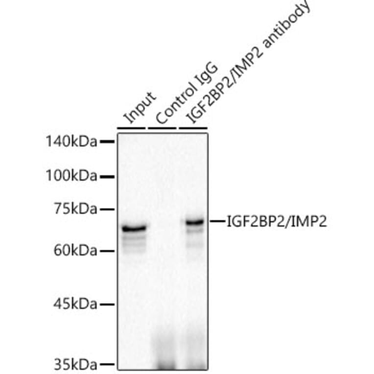 Western Blot - Anti-IGF2BP2/IMP-2 Antibody [ARC1203] (A308035) - Antibodies.com