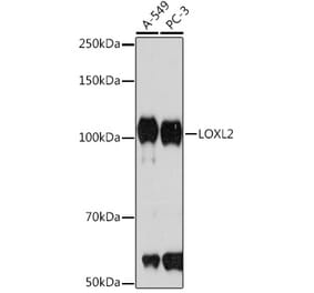 Western Blot - Anti-LOXL2 Antibody [ARC1100] (A308036) - Antibodies.com