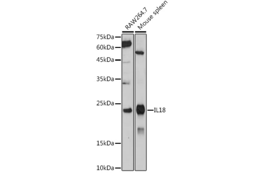 Western Blot - Anti-IL-18 Antibody (A308037) - Antibodies.com