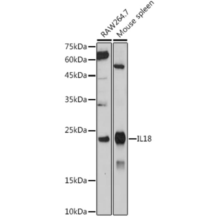 Western Blot - Anti-IL-18 Antibody (A308037) - Antibodies.com