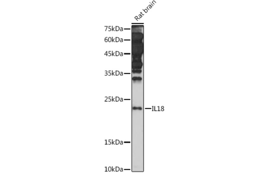 Western Blot - Anti-IL-18 Antibody (A308037) - Antibodies.com