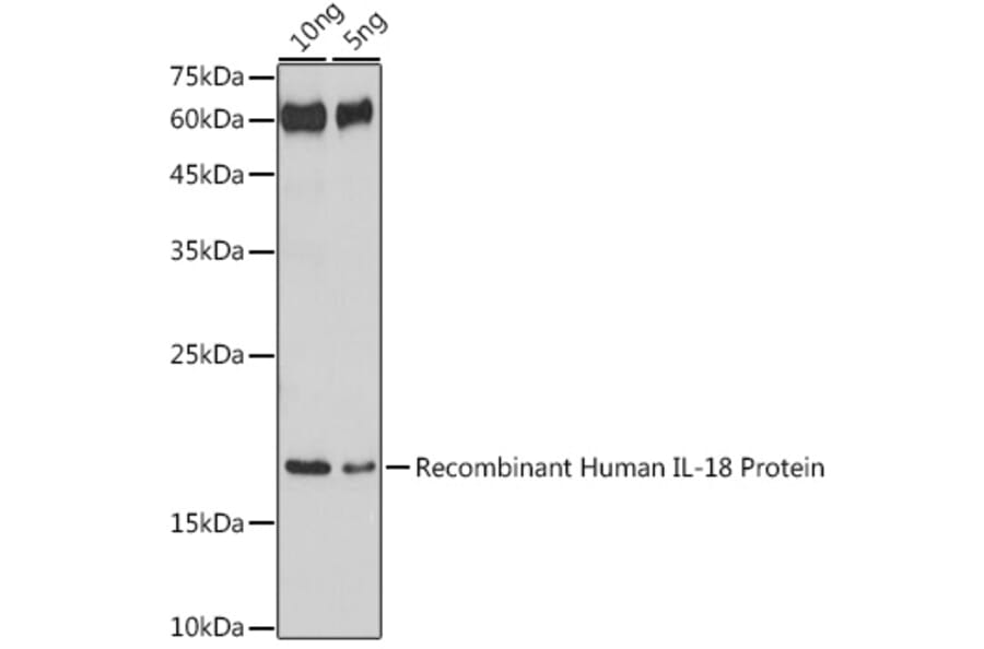 Western Blot - Anti-IL-18 Antibody (A308037) - Antibodies.com