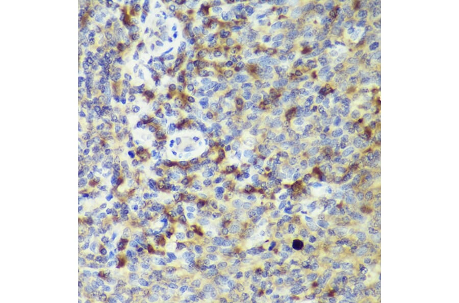Immunohistochemistry - Anti-IL-18 Antibody (A308037) - Antibodies.com