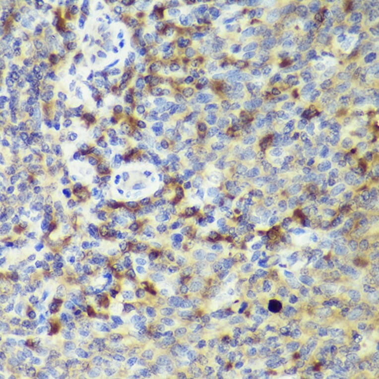 Immunohistochemistry - Anti-IL-18 Antibody (A308037) - Antibodies.com
