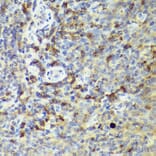 Immunohistochemistry - Anti-IL-18 Antibody (A308037) - Antibodies.com