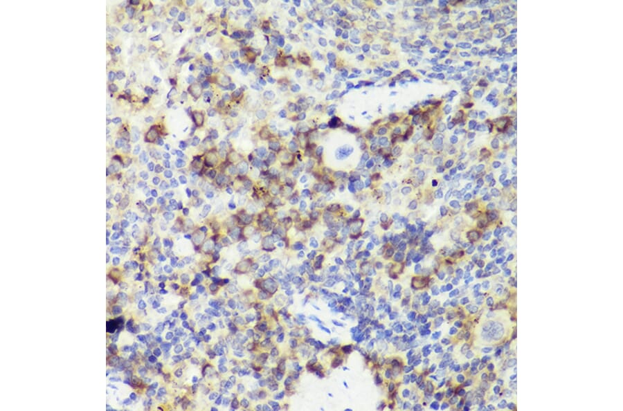 Immunohistochemistry - Anti-IL-18 Antibody (A308037) - Antibodies.com