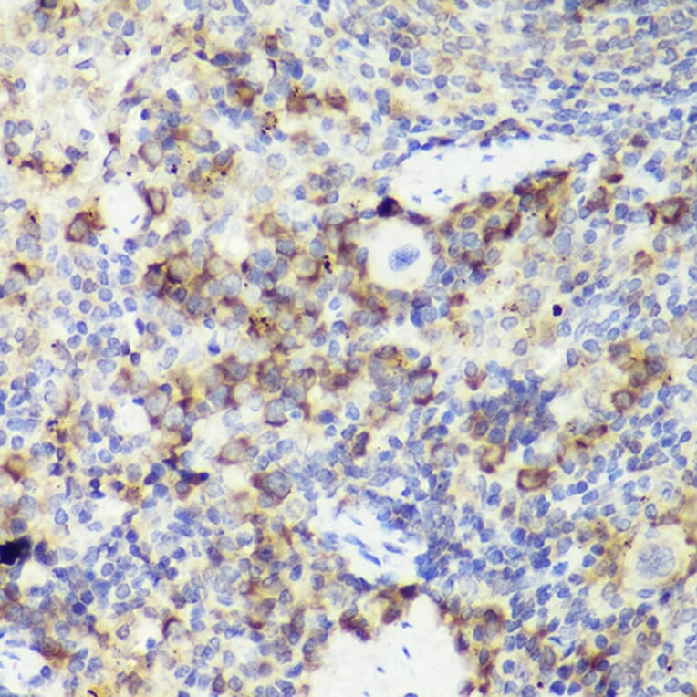 Immunohistochemistry - Anti-IL-18 Antibody (A308037) - Antibodies.com