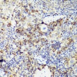 Immunohistochemistry - Anti-IL-18 Antibody (A308037) - Antibodies.com