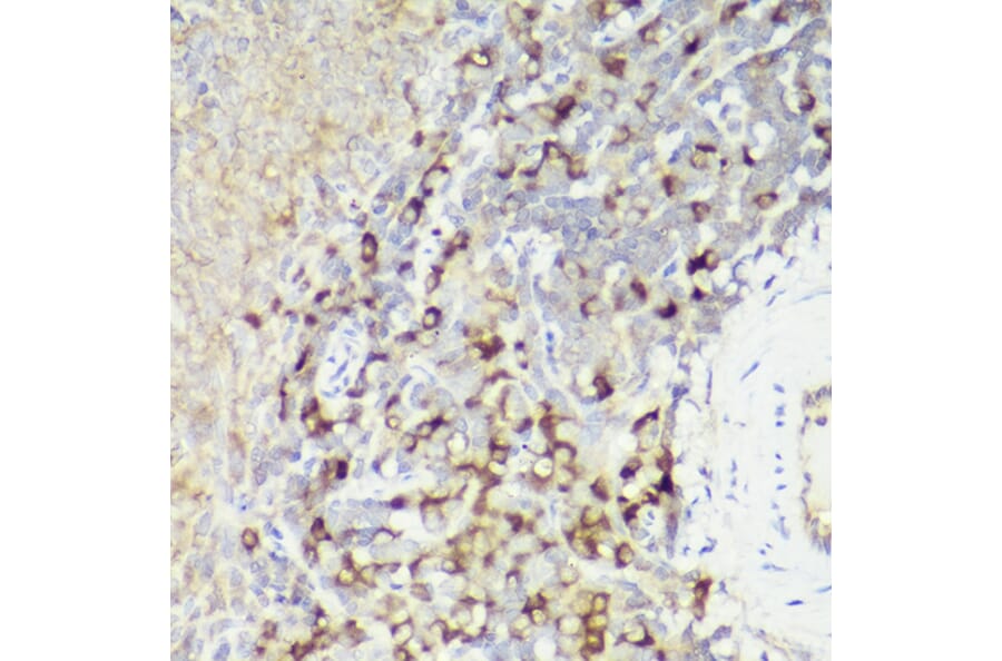Immunohistochemistry - Anti-IL-18 Antibody (A308037) - Antibodies.com