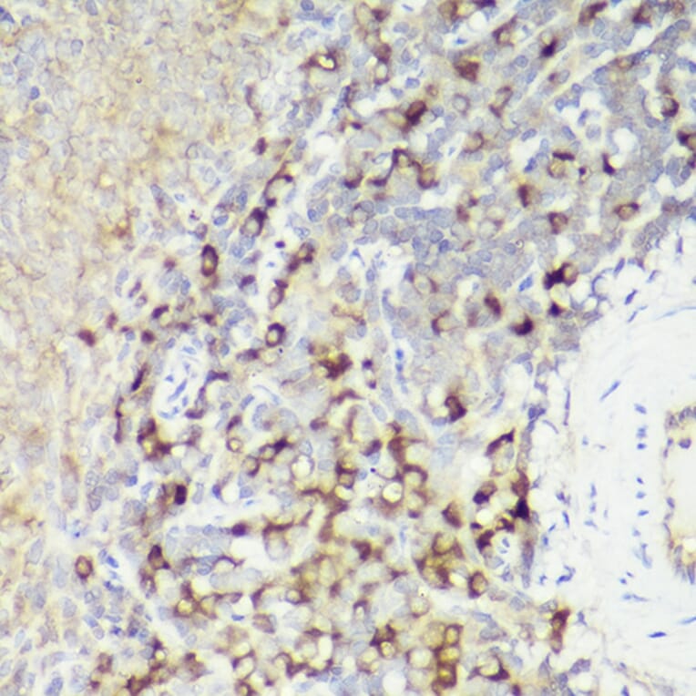 Immunohistochemistry - Anti-IL-18 Antibody (A308037) - Antibodies.com