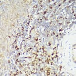 Immunohistochemistry - Anti-IL-18 Antibody (A308037) - Antibodies.com